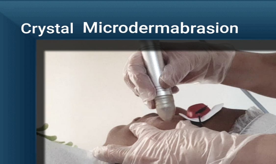 Crystal Microdermabrasion